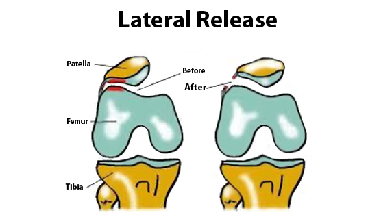 Anterior knee 10