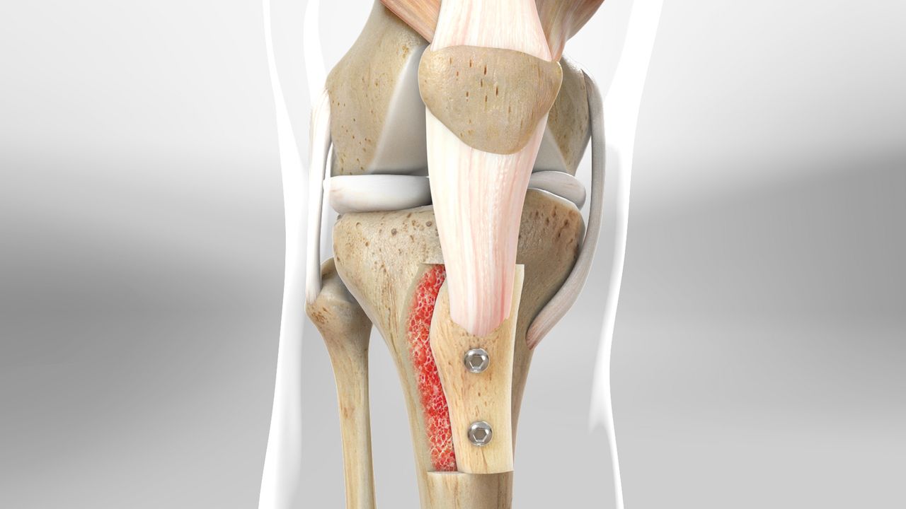 Anterior knee 11