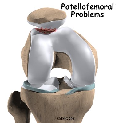 Anterior knee 4