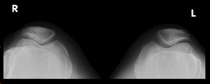Anterior knee 5