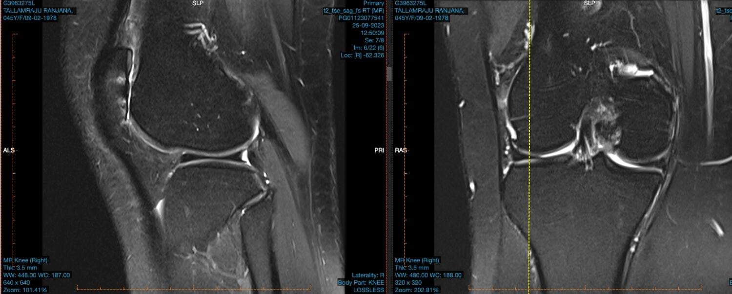 Anterior knee 6