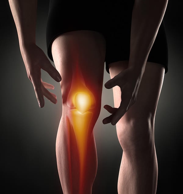 Knee Arthritis-1 Knee Arthritis-1