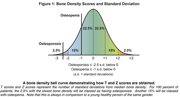 OSTEOPOROSIS-Bone Density Scores