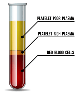 PRP-2