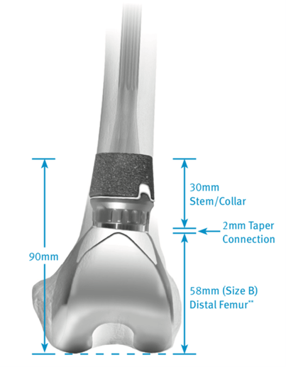 Picture2-megaprosthesis