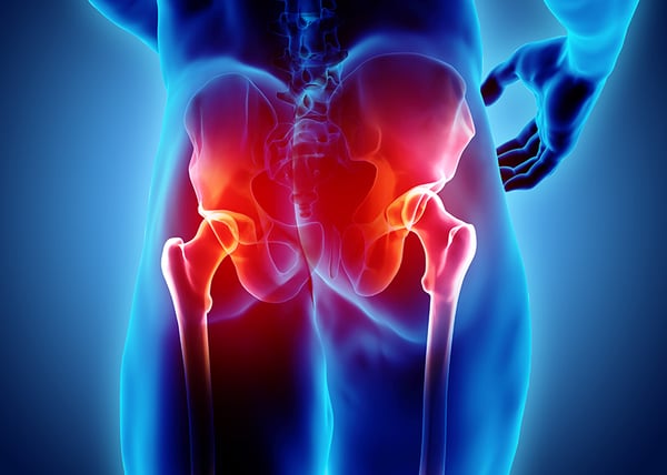 Total Hip Replacements-new
