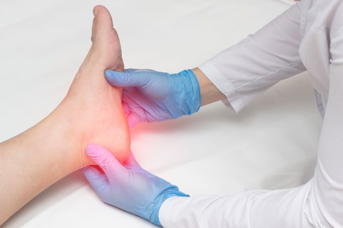 plantar fasciitis treatment options