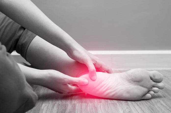 plantar fasciitis