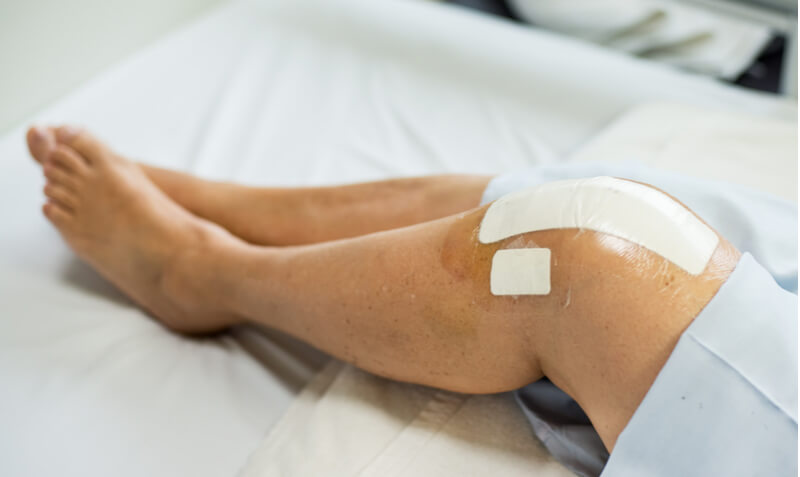 rehabilitation process partial knee replacement