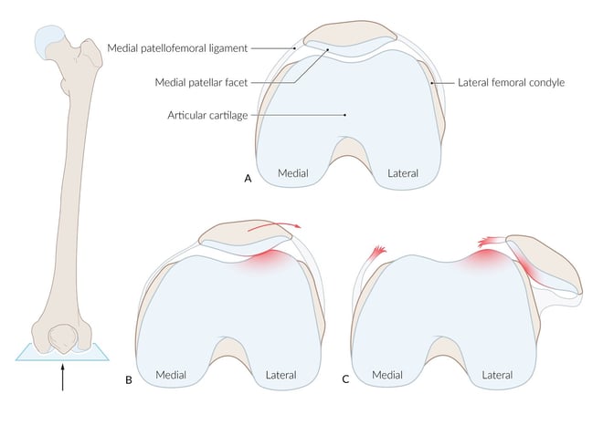 Patella 7