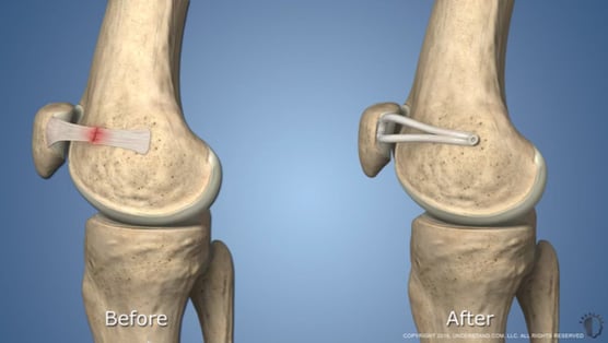Patella 8