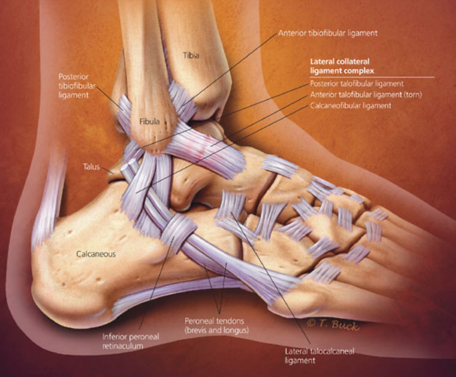 Treatments For Ankle Sprain & Injuries