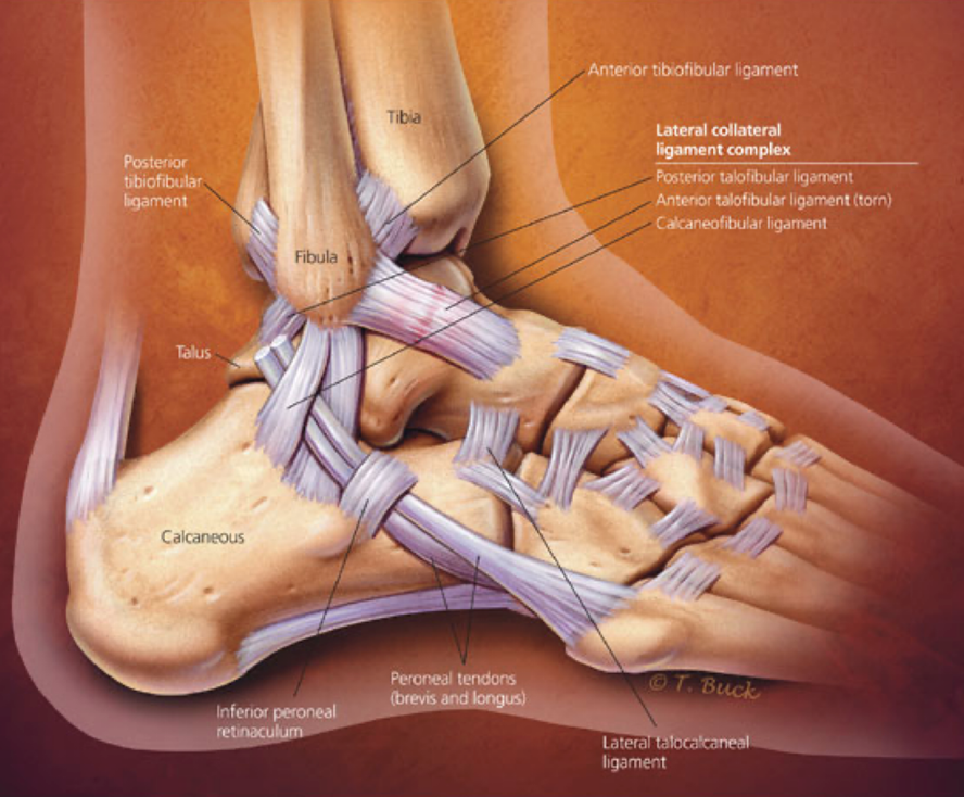 Ankle Sprain