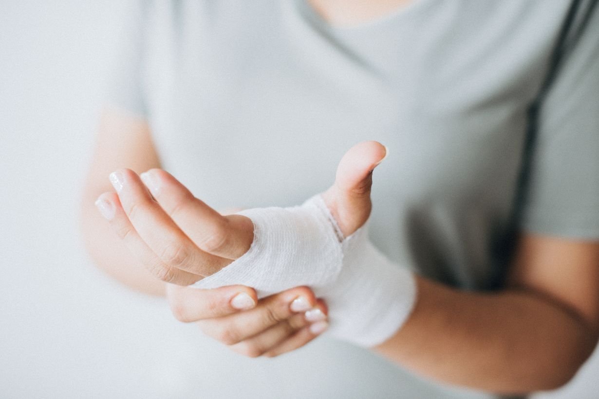 hand-fracture-recovery